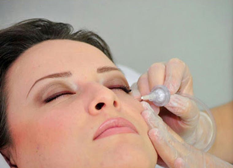 کربوکسی‌تراپی